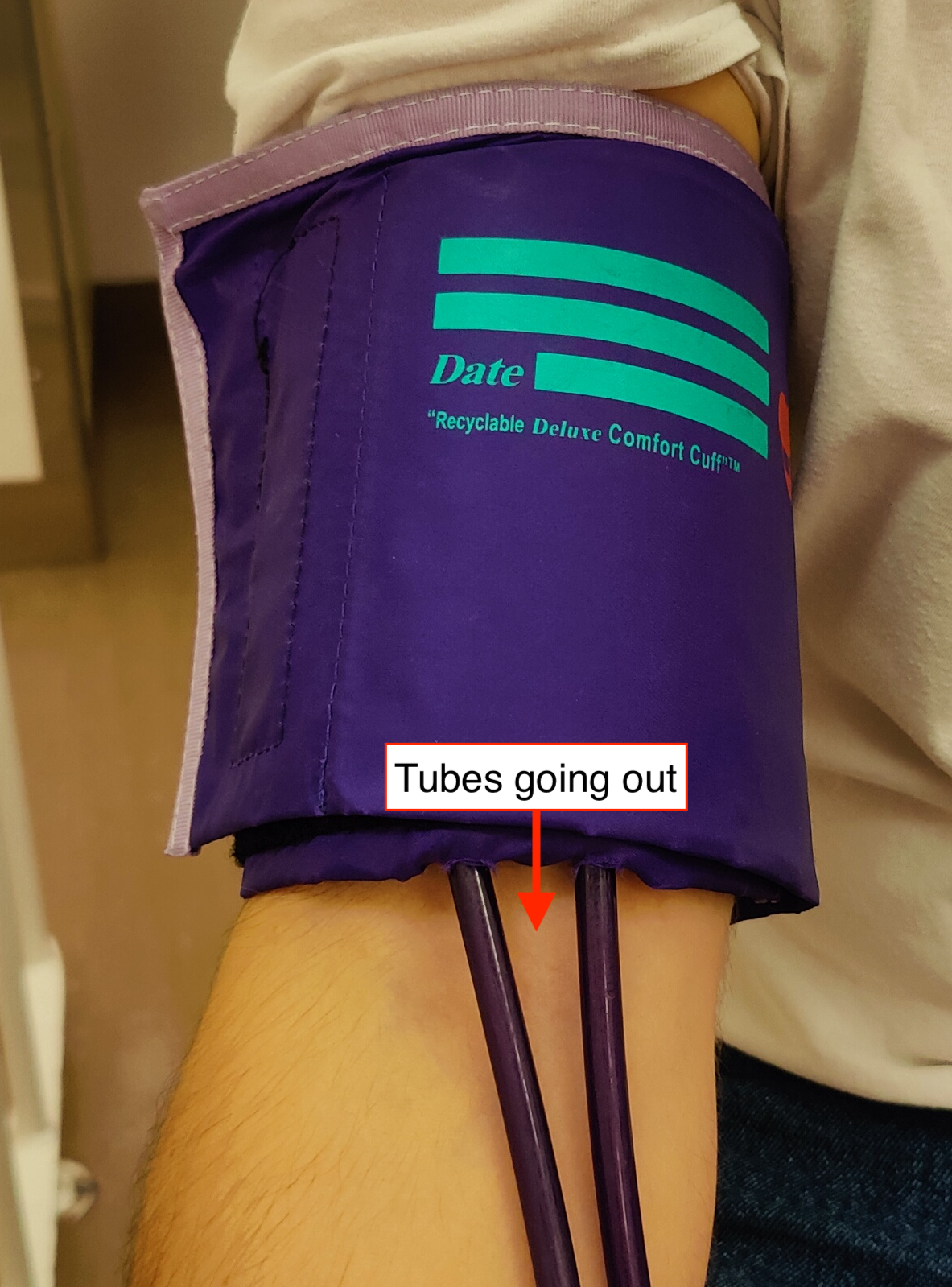 Blood pressure arm band